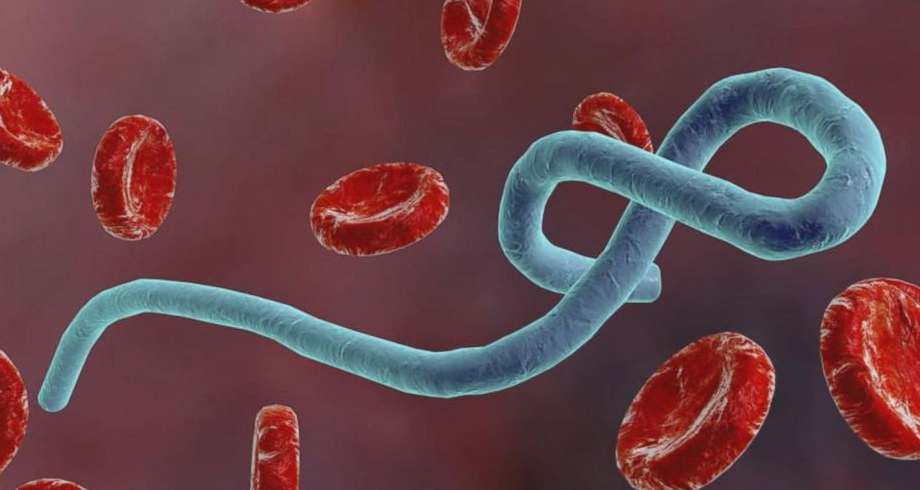 Los Estados Unidos desbloquean 80 millones de dólares adicionales para combatir la epidemia de Ebola 2 vis 0529202600145644